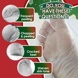 2 Pairs of Christmas Foot Care Foot Masks, Moisturising Care Foot Mask Socks, Moisturising Foot Mask, Gentle Foot Care Suitable for Men and Women, Christmas Gifts