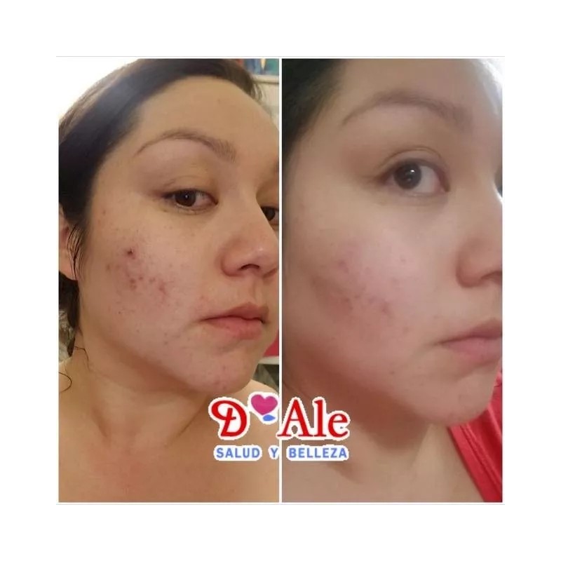 D'Ale 2 Cremas Facial Regeneradora Células Madre, Hidratante, Fps