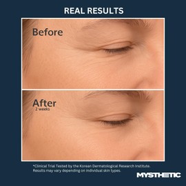 MYSTHETIC PDRN Collagen Wrapping Mask with CICA-PDRN Micro-Spicule Shots for Elasticity, Pore-Minimizing, Hydration, Glow - Korean Skin Care - 2.7 FL. OZ.