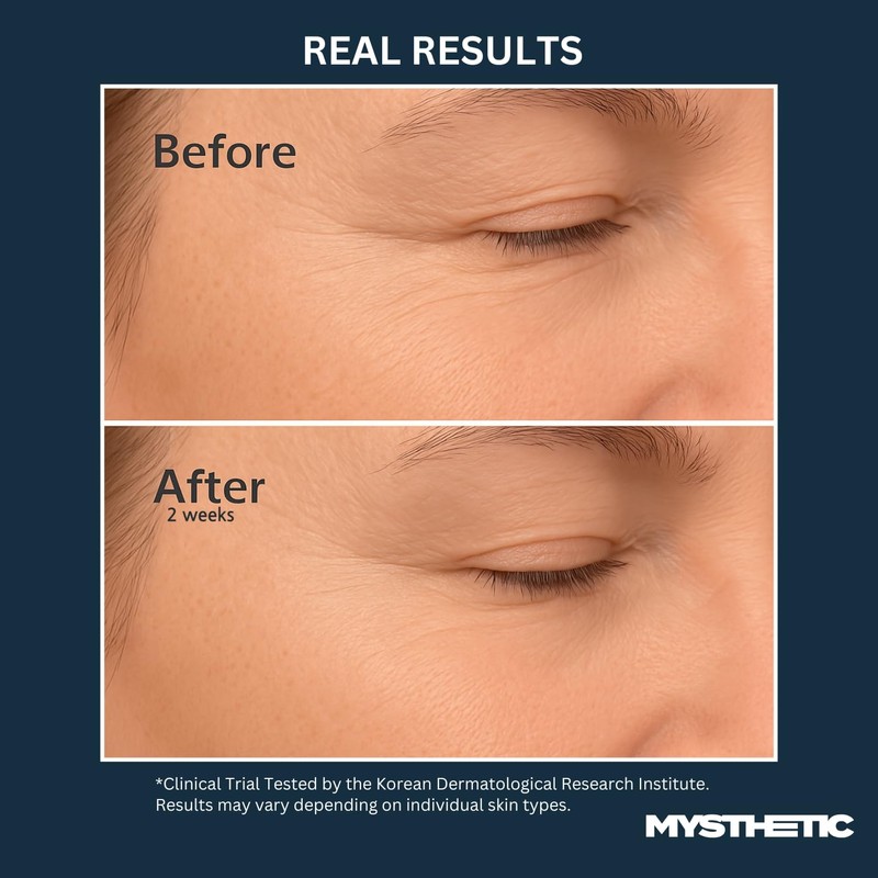 MYSTHETIC PDRN Collagen Wrapping Mask with CICA-PDRN Micro-Spicule Shots for