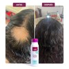 Kaba Shampoo Anti Caida de Cabello de Cebolla Roja, Estimula