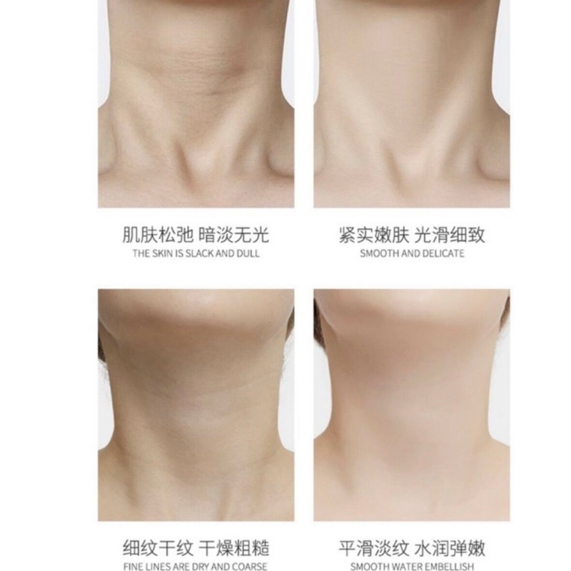 【ReadyStock】山羊奶颈膜✨美白淡化颈纹🥛Goat Milk Neck Mask Whitening and Anti Wrinkle Mask颈项面膜