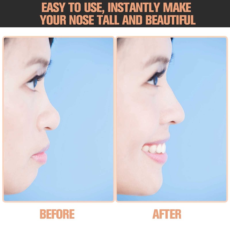 Maitys 2 Sets Nose up Lifting Shaper Clip Clipper Nose