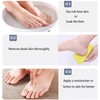 2 PCS Double-Sided Pumice Stone for Feet, Foot Scrubber，Effective Pedicure