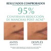 Eucerin Dermopure Oil Control Sérum Triple Efecto Antibrillo para Piel