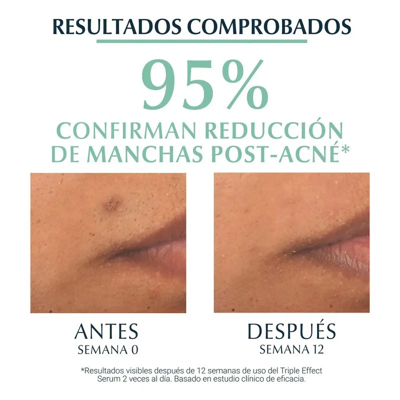Eucerin Dermopure Oil Control Sérum Triple Efecto Antibrillo para Piel