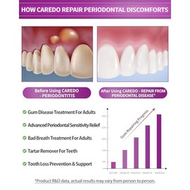 CAREDO- TRATAMIENTO PARA ENFERMEDADES DE LAS ENCÍAS EN ADULTOS: recomendada por expertos bucodentales como una pasta de dientes eficaz sin flúor para el tratamiento de enfermedades de las encías y el