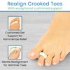 VIVEsole Hammer Toe Crest Cushion & Buttress Pad - Reduces