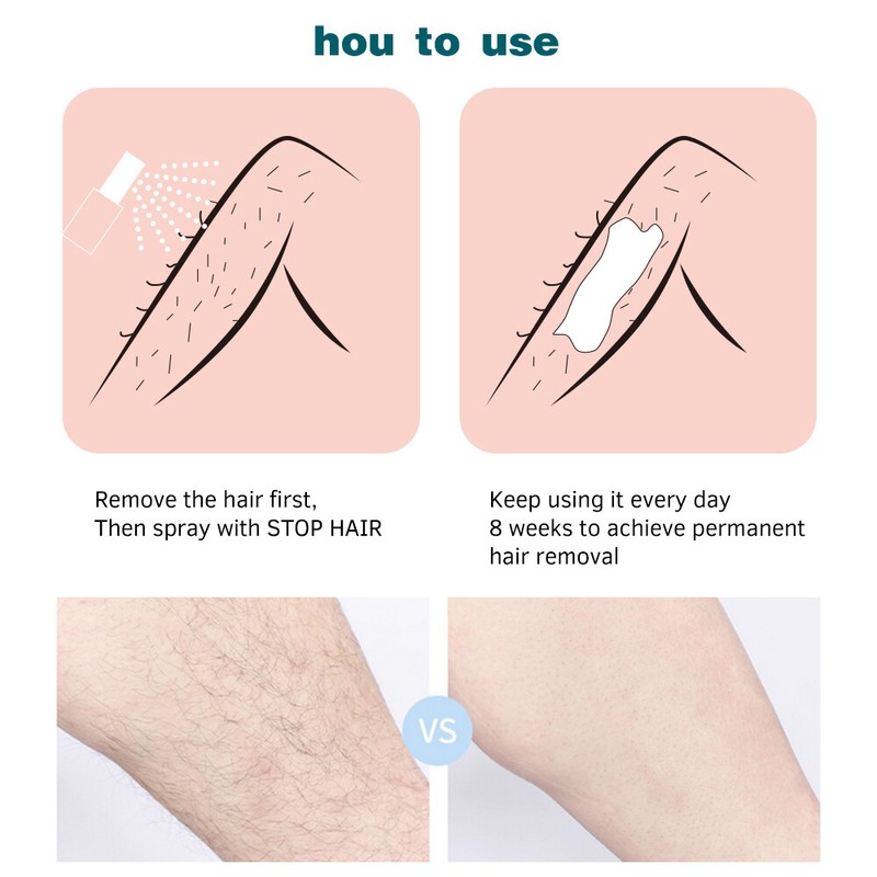 Extra Strong Permanent Hair Removal Spray Stop Hair Growth Inhibitor