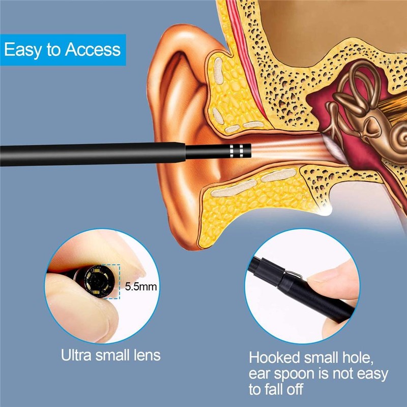 3 in 1 Ear Spoon Intelligent Visual Ear Picking Multifunctional