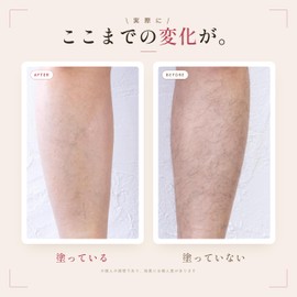 Unwanted hair, blue beard, beard, bristle gel, men's, moisturizing, for men, body hair, after razor depilation, after hair removal, after unwanted hair care, after treatment, aftershave lotion