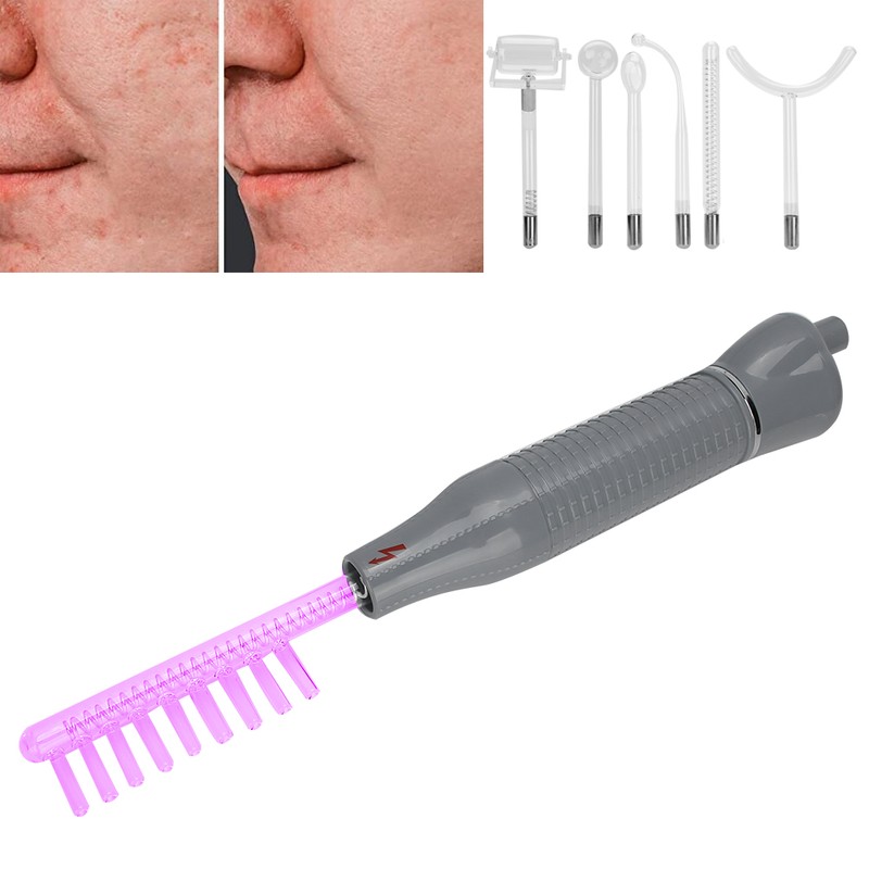 7pcs / Set High Frequency Electrotherapy Instrument Ozone Electrotherapy RodEU
