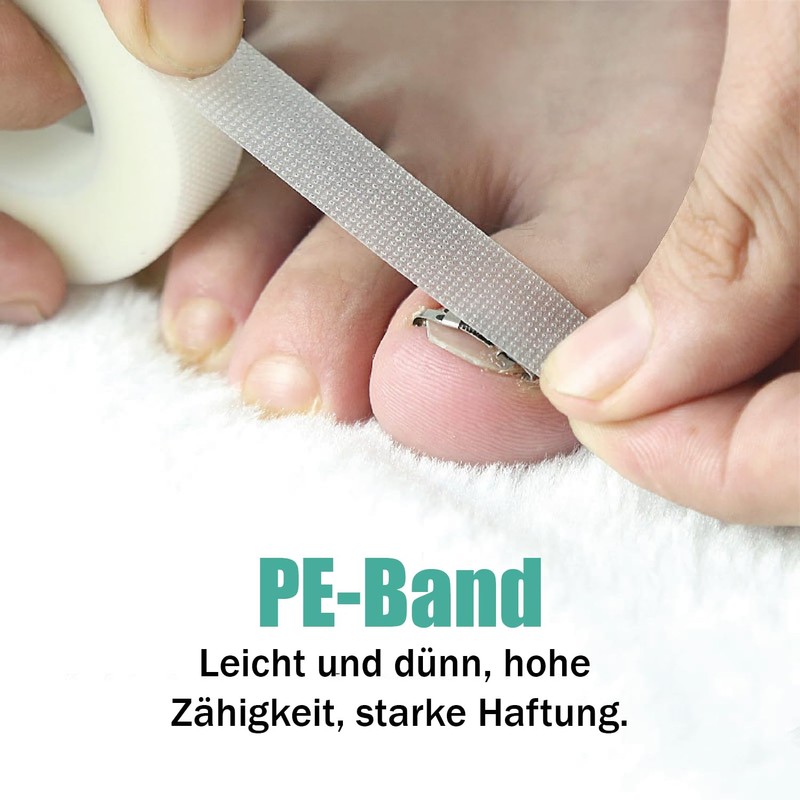 Esshogo 1 Set Ingrown Toenail Tools, Nail Correction Buckle, Patch