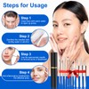Pimple Popper Tool Kit,10 Pcs Professional Blackhead Remover Comedones Extractor
