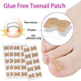 Ingrown Stickers, Corrector Pedicure Tools, Toenail Patch, Ingrown Toenails, Ingrown Toenail Tool Set - 60 Stickers