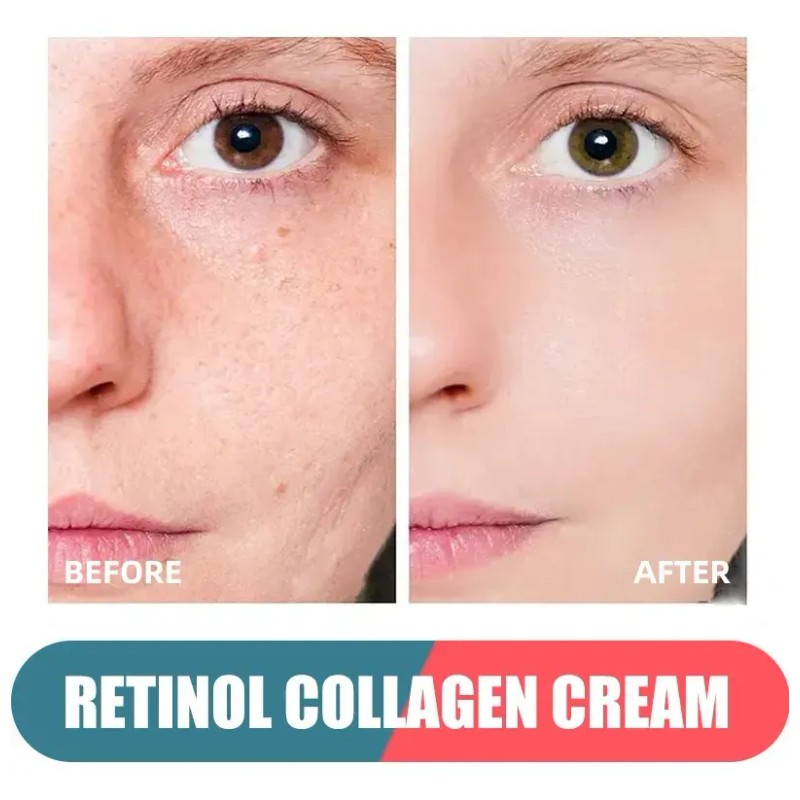 Crema Antienvejecimiento M Sxx Hh Con Retinol, Colágeno Y