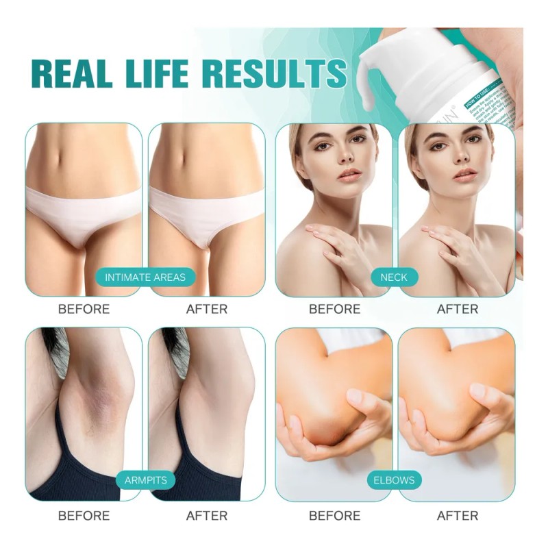 Crema Aclaradora Íntima Cuerpo Manchas Oscuras Tono Uniforme Neutra