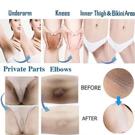 Crema en Gel Aclaradora para la Zona Íntima Corporal con Niacinamida, Arbutina y Vitamina C. para Zonas Íntimas, Axilas, Rodillas, Codos, Muslos Inter