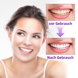 Sp-7 Probiotische Zahnpasta zum Aufhellen,Aufhellende Zahnpasta zur Fleckenentfernung Frischer Atem Reduzieren Sie Zahnflecken Kraftvolle Aufhellung Schützen Sie Zahnfleisch und Zähne