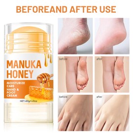 Honey Foot Cream for Extremely Dry Hands & Feet – Deep Moisturizing & Cracked Heel Repair, Nourishing Formula for Women & Men – Quickly Improves Rough Skin, 40ML