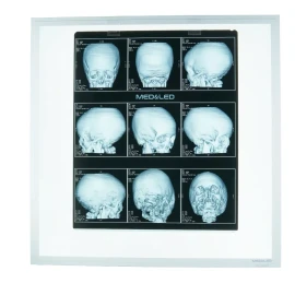 Med & Led Negatoscopio Led Profesional Con Portaplacas 3600 Lumenes