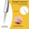 Pimple Blackhead Remover 3-Piece Tweezers Face Nose Black Head Precise