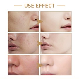 140ml Rice Water Toner,Rice Face T/oner,Rice to/ner for Women,Hydrating Ton/er,Rice Serum,Natural Moisturizer Glow Essence,Mois/turizing Soothing Tone/r,Essence Toner,Moisturizing Rice Extract