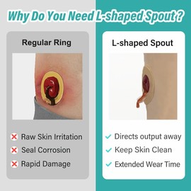 Ostomy Barrier Rings with L-shapped Output Direction Spout, Ostomy Stoma Rings with L-shapped Groove, Ostomy Supplies,Colostomy Supplies,4 Pcs/Pack (4 mm Thickness, Diameter : 1.9 Inches)