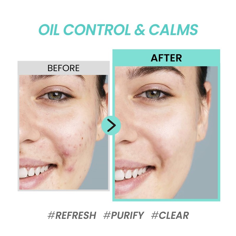 COXIR Tea Tree Oil Pores and Sebum Emulsion (100 ml,