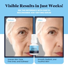 Natural Love 5% Niacinamide Serum (B3) 5% B5 Gel, Hydrating and Moisturizing Face Serum for All Skin Types - Made in Canada