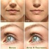 Neutrogena Vitamin C & Hyaluronic Acid Anti-Aging Serum Anti Aging