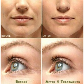 Neutrogena Vitamin C & Hyaluronic Acid Anti-Aging Serum Anti Aging Cream Face ,Eye Wrinkle