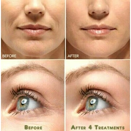 Neutrogena Vitamin C & Hyaluronic Acid Anti-Aging Serum Anti Aging Cream Face ,Eye Wrinkle