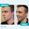 Proactiv Acne Cleanser - Benzoyl Peroxide Face Wash and Acne