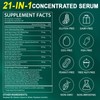 Lymphatic Drainage Supplements-Echinacea, Dandelion, Burdock Root|21-In-1 Botanical Complex for Lymph