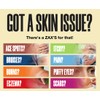 Zax's Original Burn Cream, Natural, Soothing, 6 Natural Ingredients, Heals