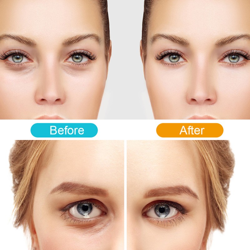 Electric Eye Massager Wand Relieve Fatigue Eye Massaging Tool for