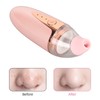 Silicone Blackhead Remover 3 Suction Levels 3 Replacement Tips USB