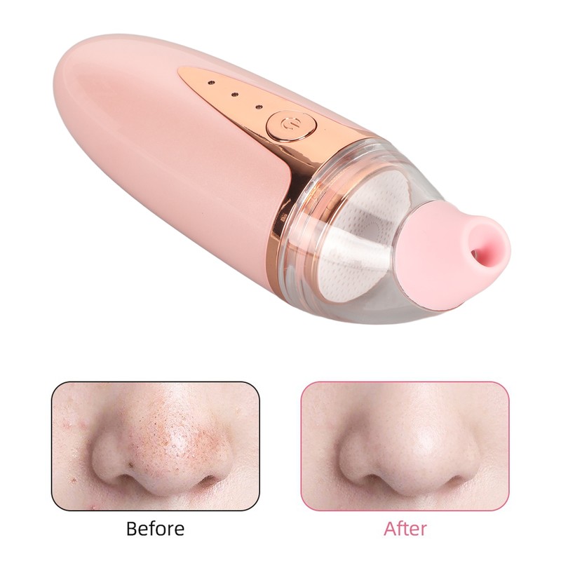 Silicone Blackhead Remover 3 Suction Levels 3 Replacement Tips USB