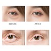 Mini Eye Ice Roller, Ice Roller for Face and Eyes,