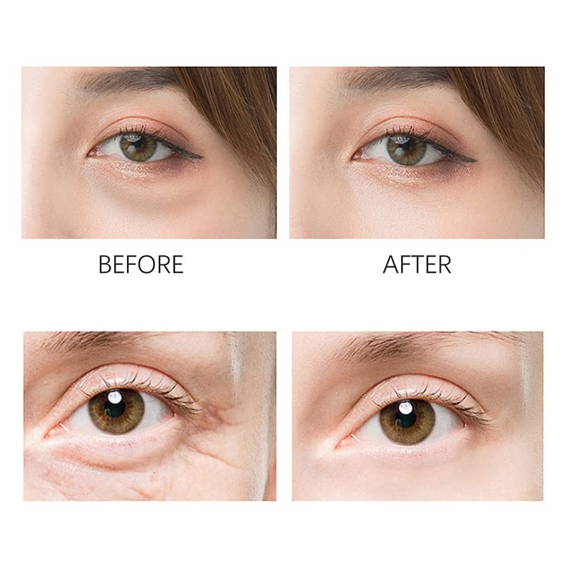 Mini Eye Ice Roller, Ice Roller for Face and Eyes,