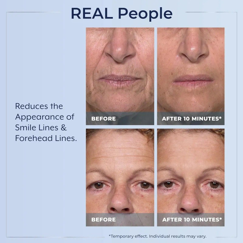 Sérum Contorno De Ojos Plexaderm Rapid Reduction: Reduce Vis