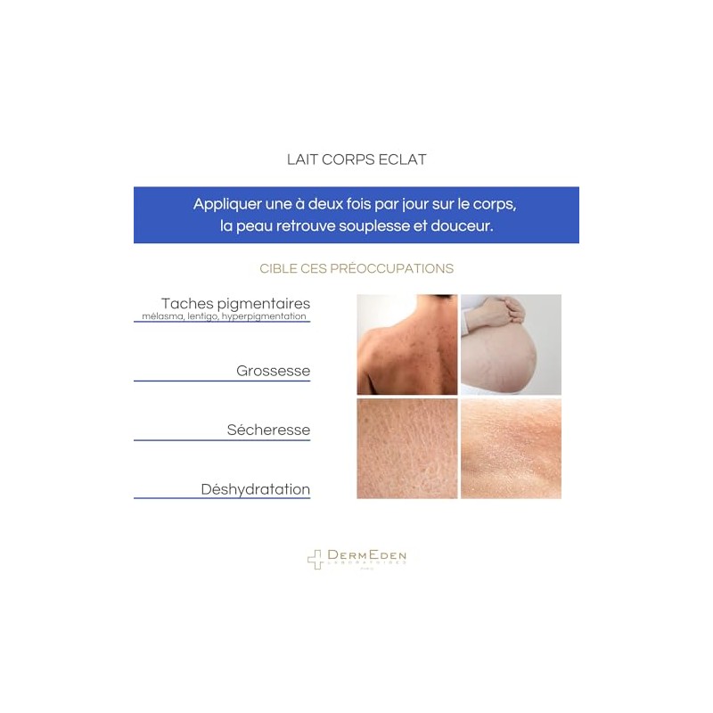 Dermeden Radiance Body Lotion Crema despigmentante e hidratante corporal 200