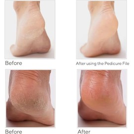 Spa-Rific Juego De 3 Limas Nano: Limas Profesionales De Cristal Resistentes Con Estuche - Herramientas Reutilizables De Cristal Para Manicura Y Pedicu