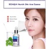 BIOAQUA Face Acne Treatment Scar Removal Spots Pimples Moisturizing Essential