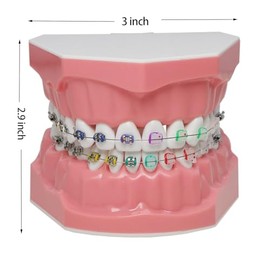 Dental Typodonts - Modelo de dientes de demostración de ortodoncia con alambres de metal, colores, ligaduras de cerámica, soportes de enseñanza, aprendizaje, modelo de educación para adultos y niños