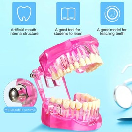 RETROGOO Disease Teeth Model Dental Typodonts Implant Teeth Model with Removable Teeth Pathological Demonstration (Pink,2 Pcs)