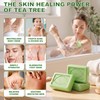 Tea Tree Soap, Tea Tree Oil Body Wash Soap Bar
