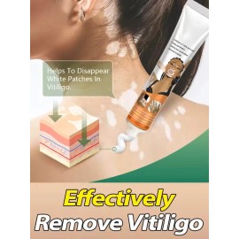 2 Cremas Vitiligo Tratamiento Premium Para La Piel. Todo Tipo De Piel Día/noche