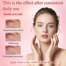 Wart Removal, Skin Tag Removal Kit, Skin Tags Remover, Fast-Acting Skin Tag & Mole Remover, for Hands & BodyFor Common Warts Plantar Warts, Corn and Calluse, Suitable for All Skin Types